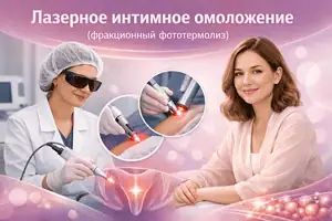 Лазерное интимное омоложение