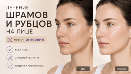 Лечение шрамов и рубцов на лице — современные методы восстановления кожи