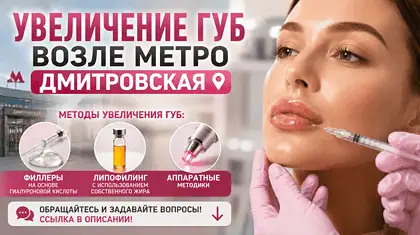 Увеличение губ возле метро Дмитровская — натуральный результат коррекции губ гиалуроновой кислотой