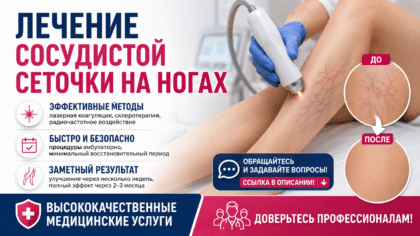 Лечение сосудистой сеточки Савеловская — лечение сосудов в клинике Москвы
