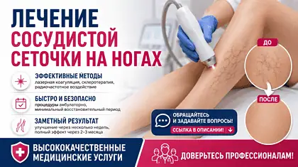 Лечение сосудистой сеточки Савеловская — лечение сосудов в клинике Москвы