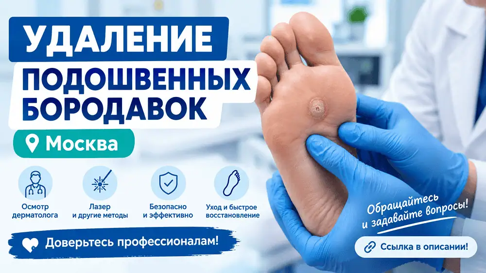 Подошвенная бородавка на стопе удаление, результат без боли, Москва